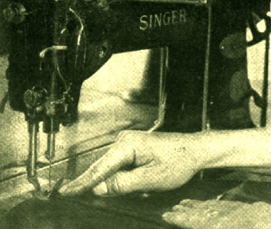 assignable cause nedir